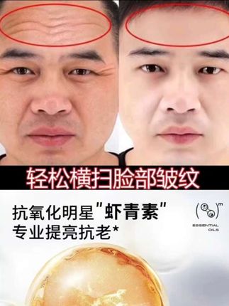 男士抗皱面霜 (买1送1)抗皱面霜男士紧致补水保湿收毛孔清爽润肤精华#抗老 #男士抗皱面霜