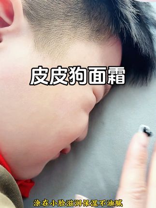 #皮皮狗舒润霜防皴霜 舒润霜(四季可用),0岁+婴幼/儿童/学生/成人,都可用的,按压设计,3重胡萝卜精粹+雪绒花+积雪草植萃复配,亲肤水润,四季可用; 防皴霜(秋冬适用),0岁+婴幼/儿童/学生/成人,都可用的,按压设计,3重胡萝卜精粹+山茶花+水解红澡植萃复配,滋润防皴不油腻不闷肤 还可以当作贴贴霜/妆前打底哦。#婴儿面霜 #防皴面霜#舒润保湿霜#日用百货好物推荐