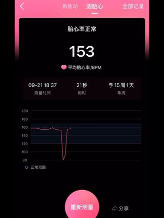 终于自己在家听到宝宝胎心啦!这次一下就找到了!太有幸福感啦!#胎心 #孕期 #孕期记录 #胎心监护 #怀孕