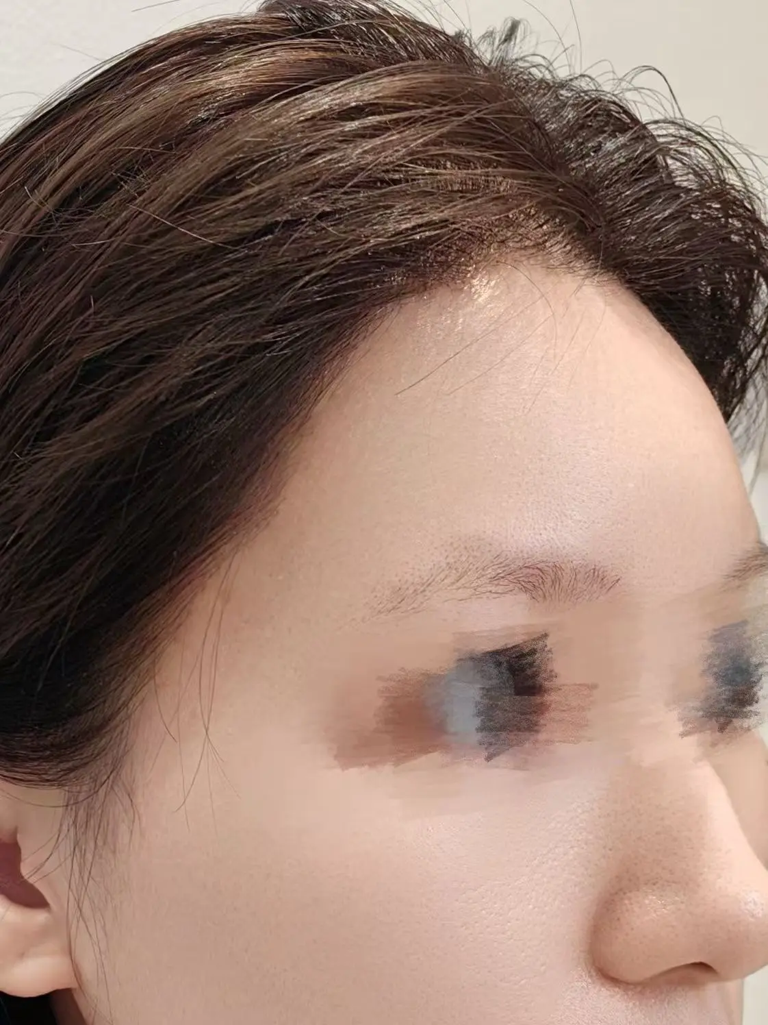 上海做的发际线就这?洗完头吹干,风筒不敢开太热不敢靠太近,生 - 抖音