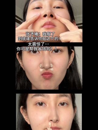 予曦,你赶紧带货吧!!真的没谁了#鼻翼贴 #鼻翼缩小 #鼻子变好看