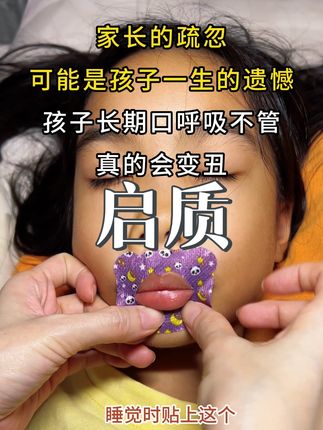 小孩张嘴睡觉会变丑••#口呼吸对颜值的影响#张嘴睡觉 #闭嘴贴#口呼吸纠正#下巴后缩