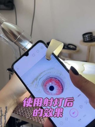 搭配射灯后的效果瞳孔缩小,眼周围也比较清晰了 #好物推荐 #热门 #鸽子