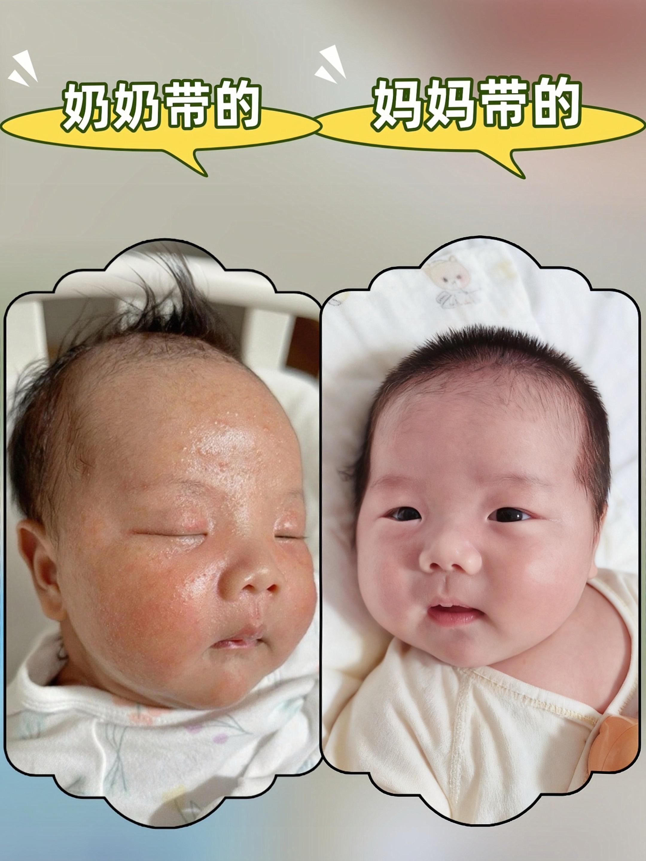 娃脸一到换季就干红?我宝贝都是用#皮帕熊婴儿多效面霜 质地像融化的奶霜,涂完水嫩嫩的,金银花舒缓超温和,新生儿也能放心用~四季涂都不黏腻,国两瓶够用到明年!#宝宝面霜推荐#婴儿护肤 #新手妈妈必入#新手妈妈