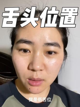 原来舌头在嘴巴里放错位置影响健康和颜值啊,难怪我地包天… #精神状态belike #无语 #牙齿矫正 #地包天 #变美那些事 @抖音小助手 @DOU+小助手