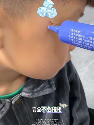 家里带娃必备!别让小伤口的印子跟着娃长大,疤痕体质宝宝天天涂,温和配方不挑皮肤,用一次就知道靠谱~ #可孚 #可孚疤痕凝胶 #宝妈好物#好物推荐🔥#自用好物推荐