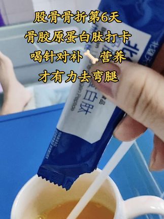 股骨骨折第6天,骨胶原蛋白肽打卡,喝针对补🦴营养,才有力去弯腿#骨折恢复记录 #股骨骨折 #髌骨粉碎性骨折 #抖音激励创作者计划 @DOU+小助手 @DOU+上热门