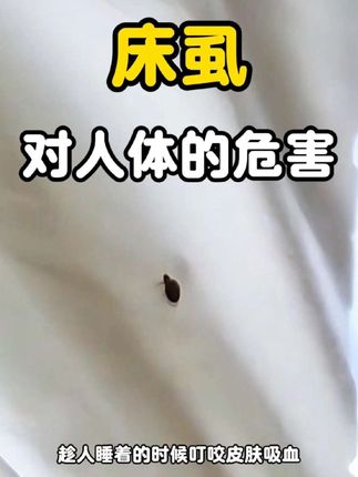 床虱对人体的危害 这种经常藏在床垫缝隙中的虫子就是床虱  它们大多在夜里出来活动   趁人睡着的时候叮咬皮肤吸血 床虱的唾液中含有致敏物质 被它们叮咬后皮肤会冒出红疹  而且特别痒  小孩子忍不住去抓的话  很容易把皮肤抓破引发感染  严重时还会出现发热现象   影响睡眠质量  时间长了  精神状态会越来越差  解决床虱的出现   清洁工作是基础  要仔细清扫床垫缝隙   再使用吸尘器反复吸尘   不放过任何角落   床单被套清洗后要高温晾晒  利用高温杀死残留的虫子和虫卵  但是只靠清洁还是难以彻底清楚床虱  所以使用杀虫剂才是根除床虱最有效的办法  这款杀虫剂对床虱有较强的杀灭作用  重点对准床垫缝隙床虱藏身的地方喷洒    从而彻底解决床虱问题 #床虱 #臭虫 #床虱对人体的危害 #床虱通常藏于床垫或弹簧床中 #床虱怎么彻底去除