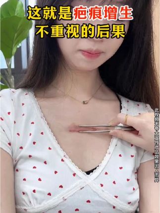 疤痕问题拖,那只会导致疤痕不断增生 #疤痕 #疤痕体质 #淡疤 #淡疤小行家 #淡疤好物