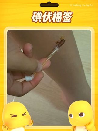 这东西是我家必备了,小男孩太淘气了,每天都有伤。一次性碘伏棉签卫生便携。#日常分享 #遇到凡事不要慌 #伤口处理