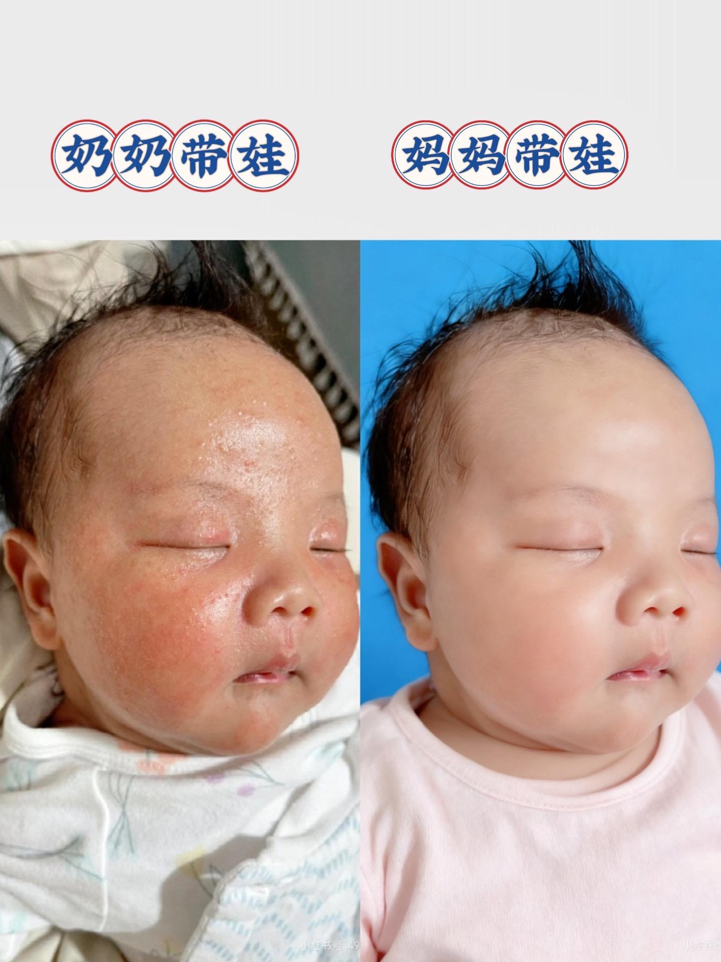 宝妈们看过来PEPA皮帕熊金银花婴儿面霜。专为宝宝设计+四季都能用,主打补水舒缓 含金银花等温和成分,给宝宝脸蛋温柔滋养, 层层锁住水分,不管是干燥时节,还是天气多 变的时候,都能守护宝宝娇嫩肌肤,让小脸蛋一 直保持水嘟嘟、软软糯糯的状态,用它给宝宝护 肤,安心又靠谱,赶紧给娃安排上,给小脸蛋 来场“水润守护”呀~#婴儿面膜#婴儿护理#新生婴儿#孕期国货#婴儿用品 @抖加🔥上热门🔥dou+🔥热点宝