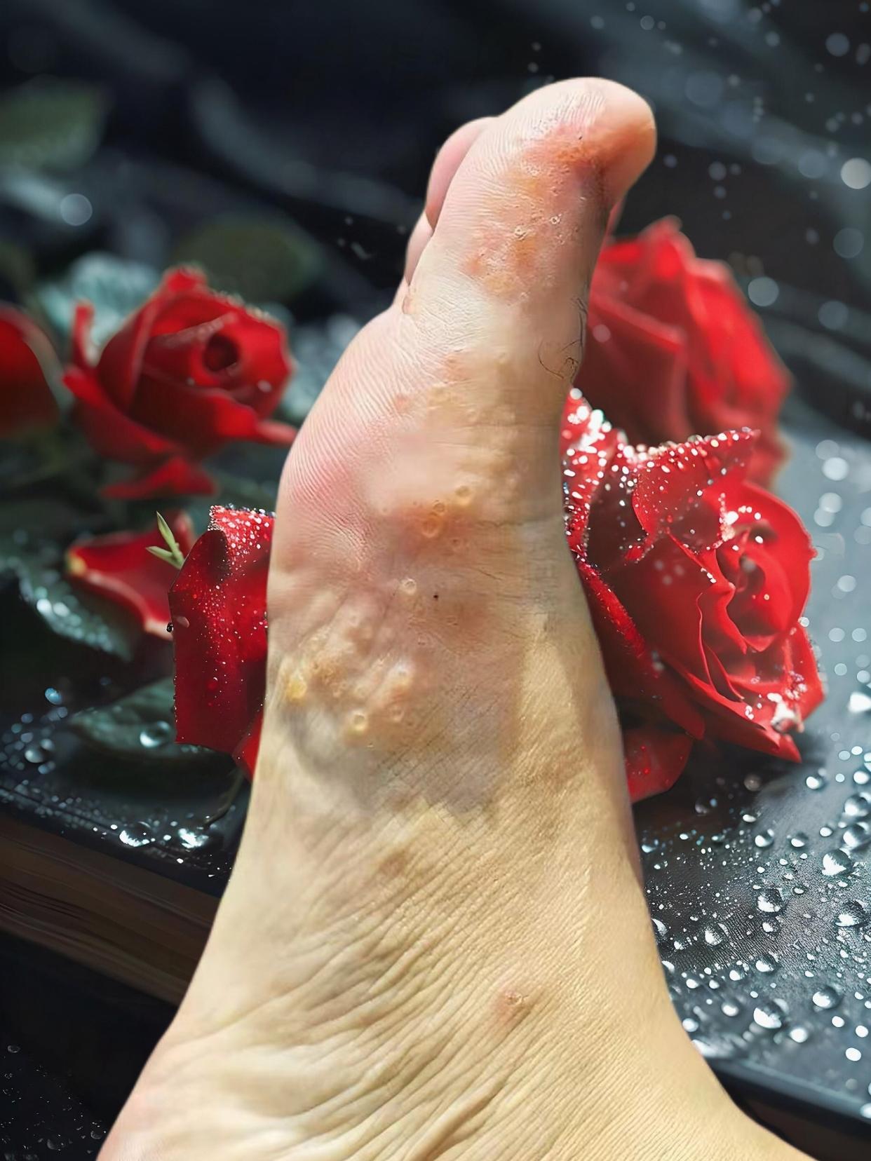 终于成功上岸,真开心!不臭不痒了!#万万没想到 #无处安放的小脚丫 #足部护理 #好物推荐 #夏天该有的样子
