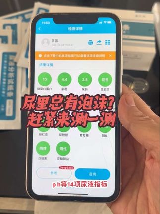 尿里总有泡沫很担心?赶紧用这个试纸条来测一测吧#尿液检测 #尿液分析试纸 #蛋白尿