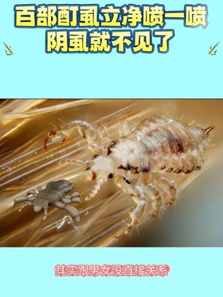 拜托大数据推给有虱子的朋友们,想消除虱子的可不要错过,百部酊喷雾剂虱子虱卵男女身体阴草本清洁儿童头虱草本植物#长虱子怎么消除 #消除虱子卵的小妙招 #百部酊喷剂 #虱子卵怎么去除#虱子
