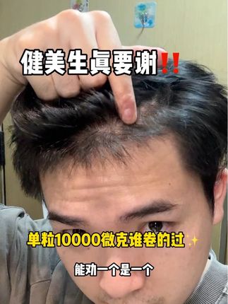 单粒10000微克生物素谁卷的过‼️老断货🥲能拍直接2瓶3瓶拍,两瓶吃半年三瓶吃九个月#女生必备 #女生必看 #生物素 #仙女必备