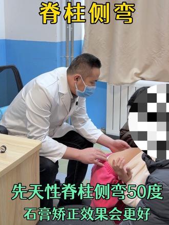 先天性脊柱侧弯50度的孩子,家长选择先打石膏矫正#脊柱侧弯 #脊柱健康 #医学科普 #先天性脊柱侧弯#儿童健康保卫计划