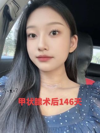 一定要远离让你不开心的人和事,消耗你的人除了给你添堵和带来一身疾病其他的什么也给不了你#爱自己多一点 #疤痕护理 #甲状腺手术