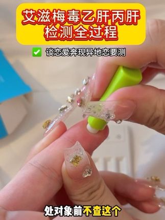 处对象前要测艾滋梅毒,不然你自己会害怕,但艾滋这些一定是得测了才知道有没有#恋爱 #奔现 #自测健康 #感染四项 #情侣