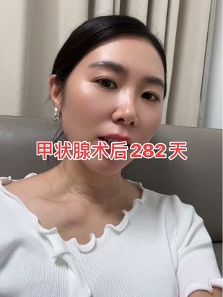甲状腺术后282天,5类,没穿穿,直接手术,术后9个月多了#甲友的日常 #甲状腺术后伤口怎么护理