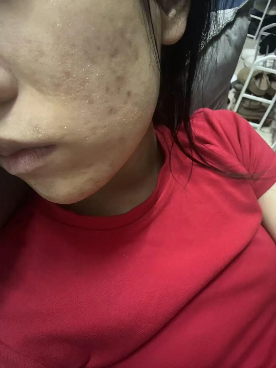护肤打卡Day20|坚持二十天聊聊现状。一晃二十天。 脸颊连 - 抖音