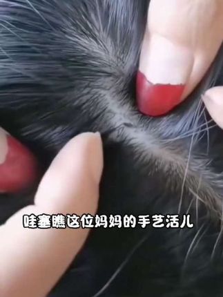 儿童头虱去虱洗发水去虱子虱卵小女孩头上通用速百部酊喷雾剂效特