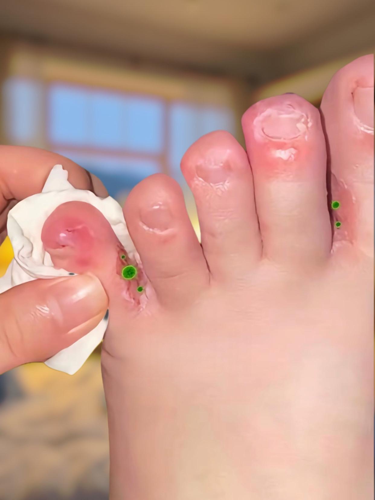 #足部护理#可爱的小脚丫#记录我的生活