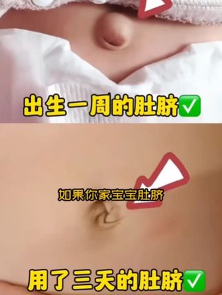 #宝妈必备 #婴儿护理 #育儿经验分享 #宝宝好物推荐 #育儿知识分享