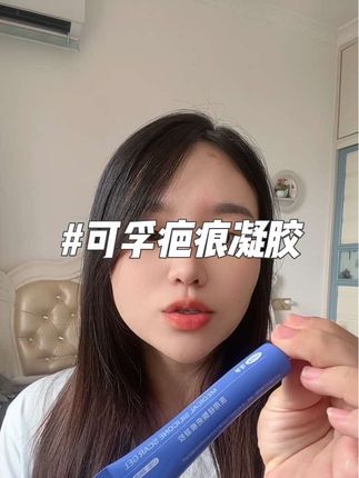 疤痕形成后再要去除就比较难了,咱们不怕一万,就怕万一,家里有孩子的一定要备上这个疤痕凝胶#自用好物推荐 #疤痕护理 #可孚疤痕凝胶 #剖腹产疤痕 #疤痕凝胶