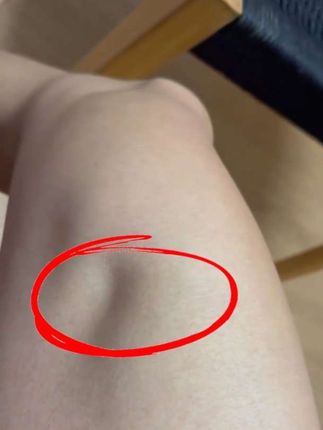 #手脚抽筋 #没错是我的腿呀