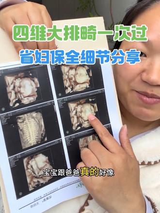 杭州省妇保四维彩超全攻略 自费 相关问题 胎教很有用哦 云影像全细节🔥 #四维彩超 #孕期产检 #怀孕那些事 #好孕连连 #产检一路绿灯