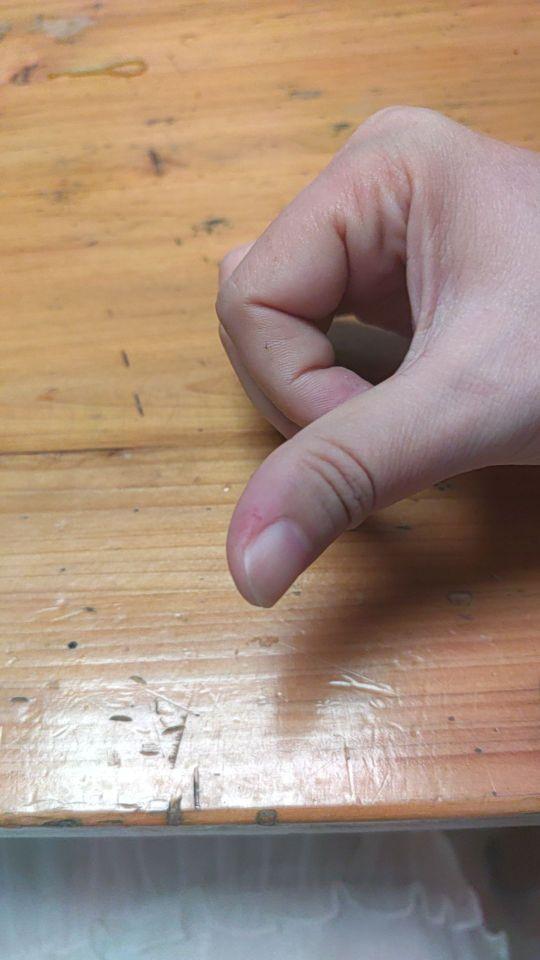 拿这个快递的时候,扎破手,出血了,这个包装缺点,容易扎破手#我在抖音买买买