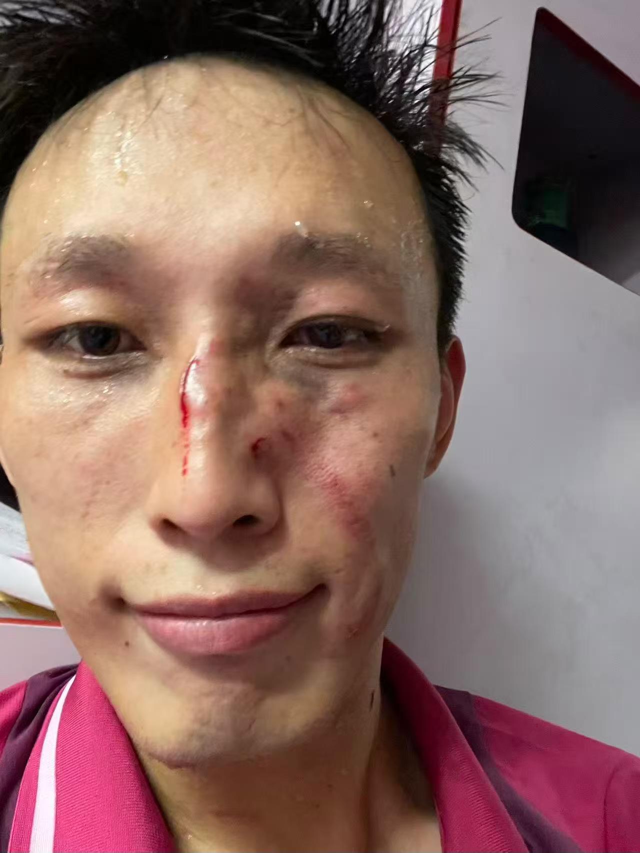 球员用血拼来的三分 我们赢了 离保级又近一步了🎉🎉🎉