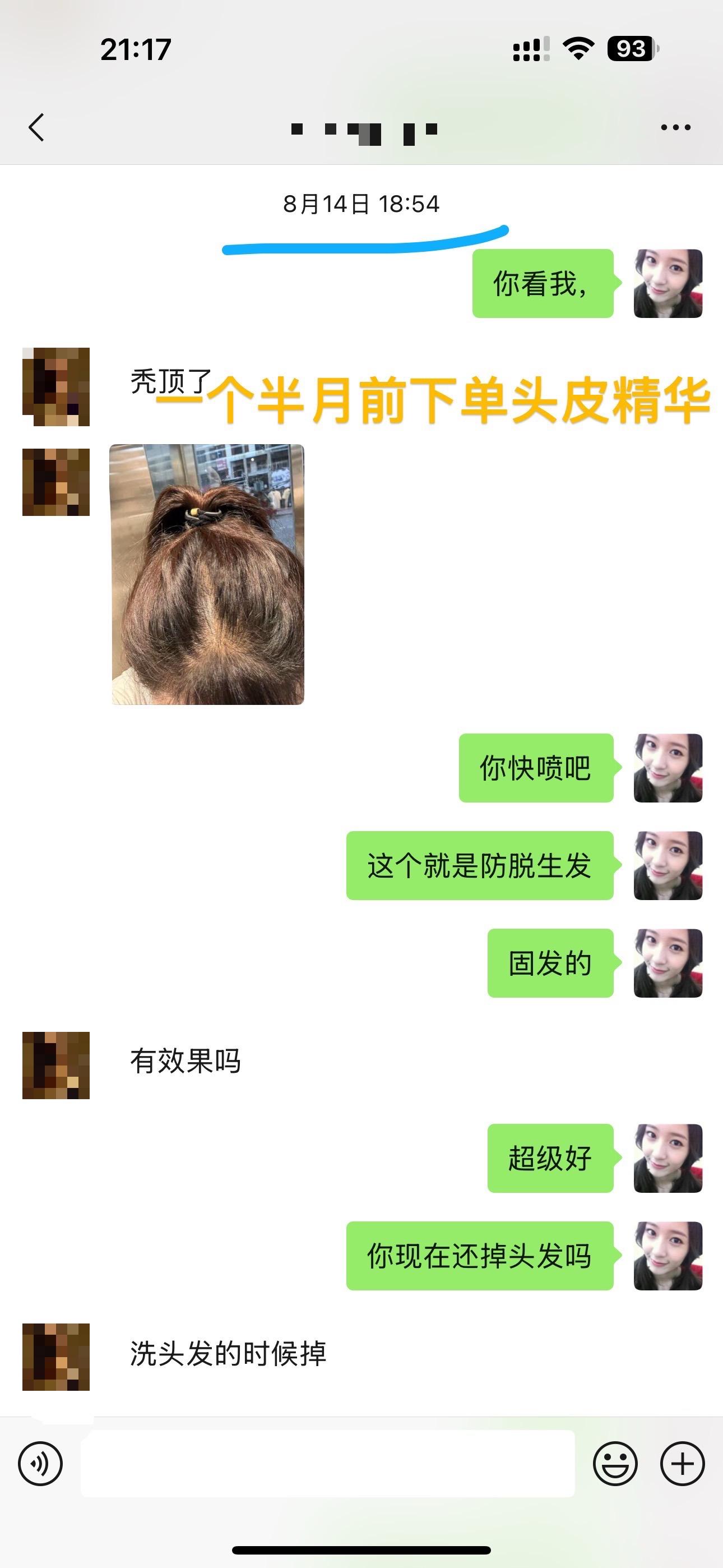 头皮精华防脱固发反馈。#曼德琳  一个半月以前,关注我几年的小姐姐,真的抱着试试看的态度下单的头皮精华,一个半月以后带着效果回购洗发水啦,顺便推荐个好朋友购买头皮精华,胖了可以瘦,丑了可以整,毛囊没了谁也没办法哦,趁现在拯救一下自己的头发吧,毕竟头发是人的第二张脸。#曼德琳防脱固发洗发水