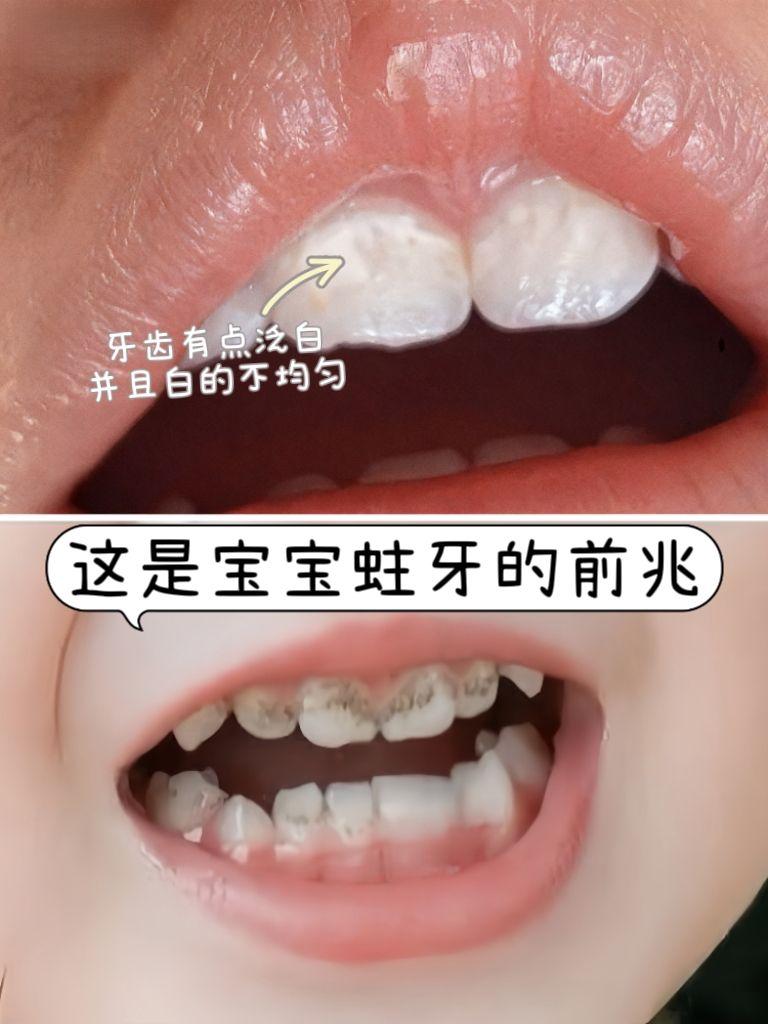 兔头妈妈护齿喷雾 | 宝宝口腔清洁小帮手✨ 专为婴幼儿设计,20ml便携装,清新果味不辣嘴,宝宝爱用! 饭后、甜食后、晨起口气,一喷搞定,养成护齿好习惯🦷 温和安全,随身携带,口腔清洁更轻松,宝妈放心! #兔头妈妈 #口齿喷雾 #宝宝口腔清洁 #每日分享