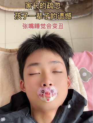 孩子经常张嘴睡觉会变丑影响颜值,要及时纠正可以试试这个#口呼吸矫正贴#张嘴睡觉会变丑 #张嘴睡觉怎么矫正 #口呼吸对颜值的影响 #腺样体面容