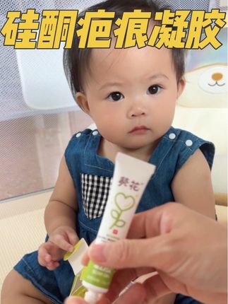 家里有孩子难免磕磕碰碰,备上一支疤痕凝胶,心里真的踏实很多~其实疤痕凝胶不用买太贵的,咱们的老国货就特别给力!家里常备两支,日常护理省心又方便 #祛疤膏 #疤痕护理 #国货之光 #母婴好物 #家庭常备
