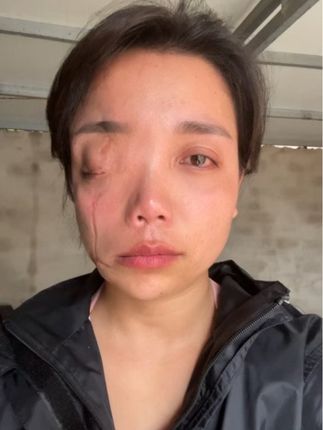 我没哭😁那是口水
