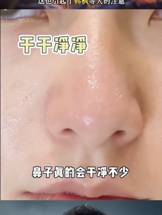 #好物分享 美女们!“sha”黑头不眨眼大法来了,轻松拥有牛奶鼻!#RNW鼻贴 #拒绝草莓鼻 #分享爱用物 @DOU+上热门 @DOU+小助手