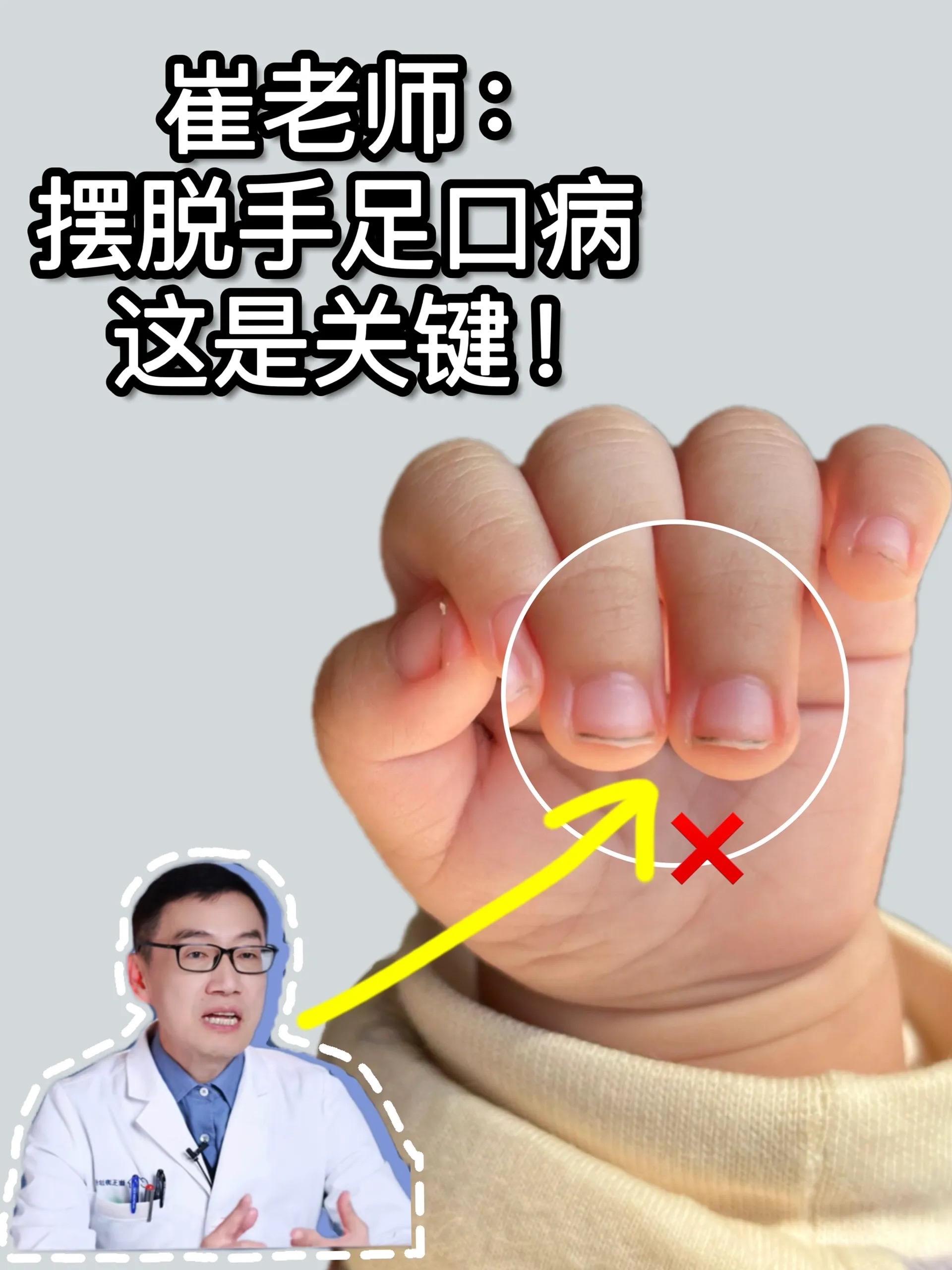 终于找到了清理宝宝指甲缝的神器啦!再也不担心吃到指甲缝里的脏东西啦#涨知识 #育儿干货 #爸妈必看