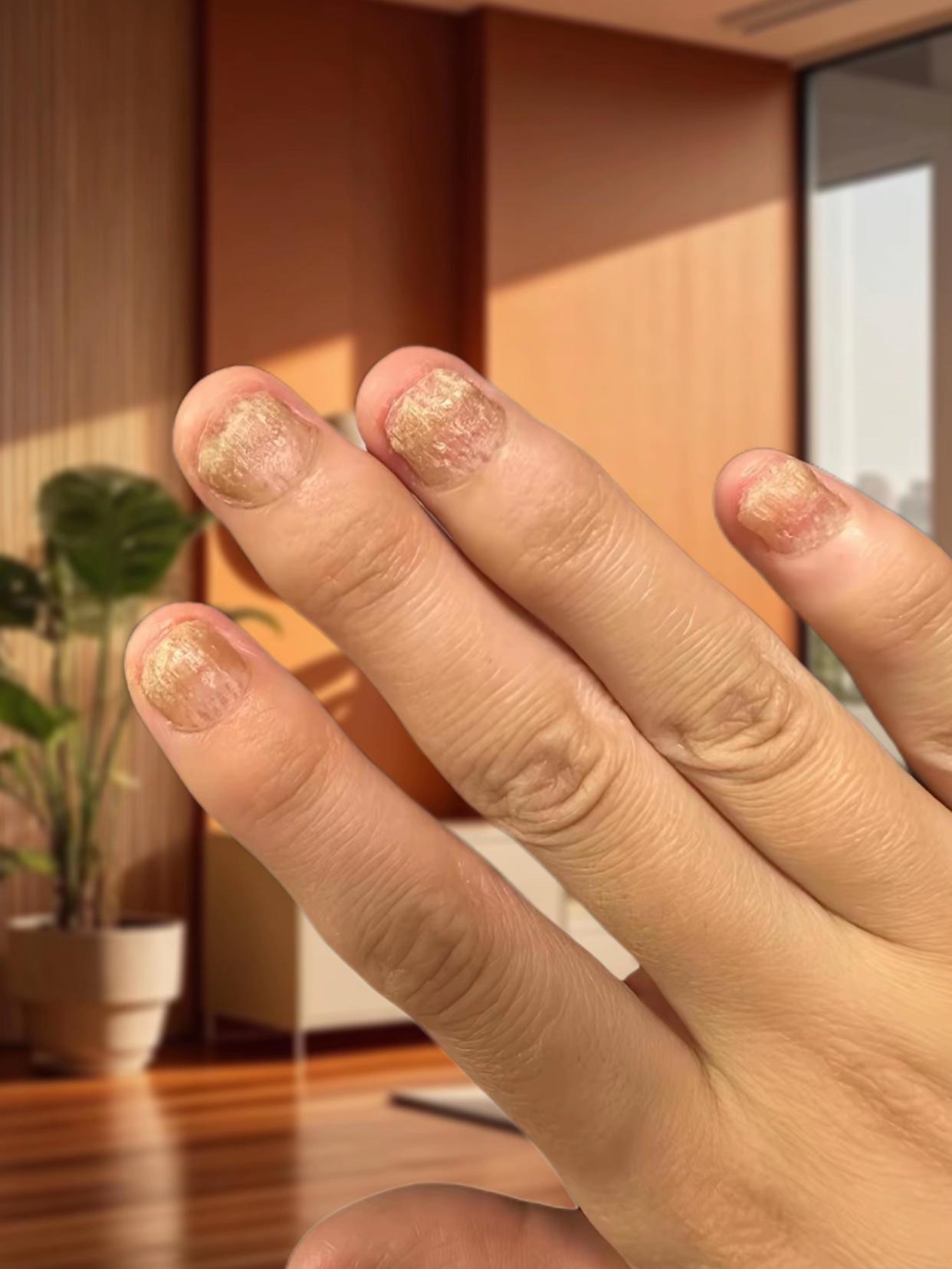 可爱的小脚丫#灰指甲 #生活碎片 #生活必备 #好物推荐#上热门