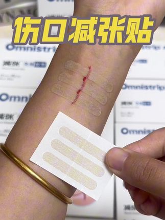 黑怕疤痕变大变丑的朋友,你就选这款奥嘉莱减张贴,真的有效果#医用减张贴 #医用疤痕贴