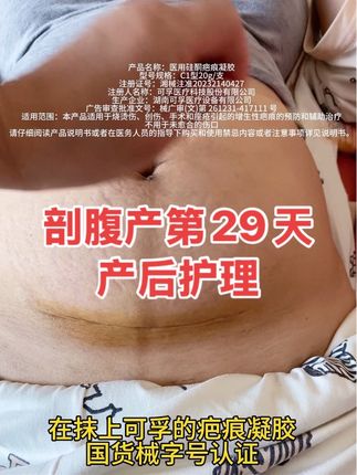 和我一样剖腹产的姐妹一定要好好护理伤口,我用的是可孚疤痕凝胶,国货老品牌,里面含有的美国进口硅酮,价格还划算,可以试试哦#剖腹产疤痕 #可孚疤痕凝胶 #产后恢复 #剖腹产