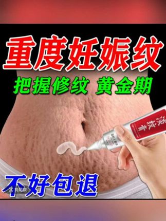 【妊娠纹修复霜孕产妇产后消除紧致淡纹肥胖纹祛除膏妊纹外消除神器】#淡纹膏#孕妇#产妇#健康养生 #关注健康@玫瑰暖铺 @抖音小助手 @抖音创作小助手 @抖音广告助手 @我要上热门 @DOU+上热门