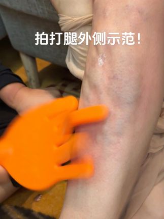 拍打小腿外侧示范! #拍打 #拍痧 #万万没想到 #阿强拍痧掌