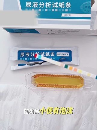 在家轻松看结果,再也不用去医院排队了#尿常规检测