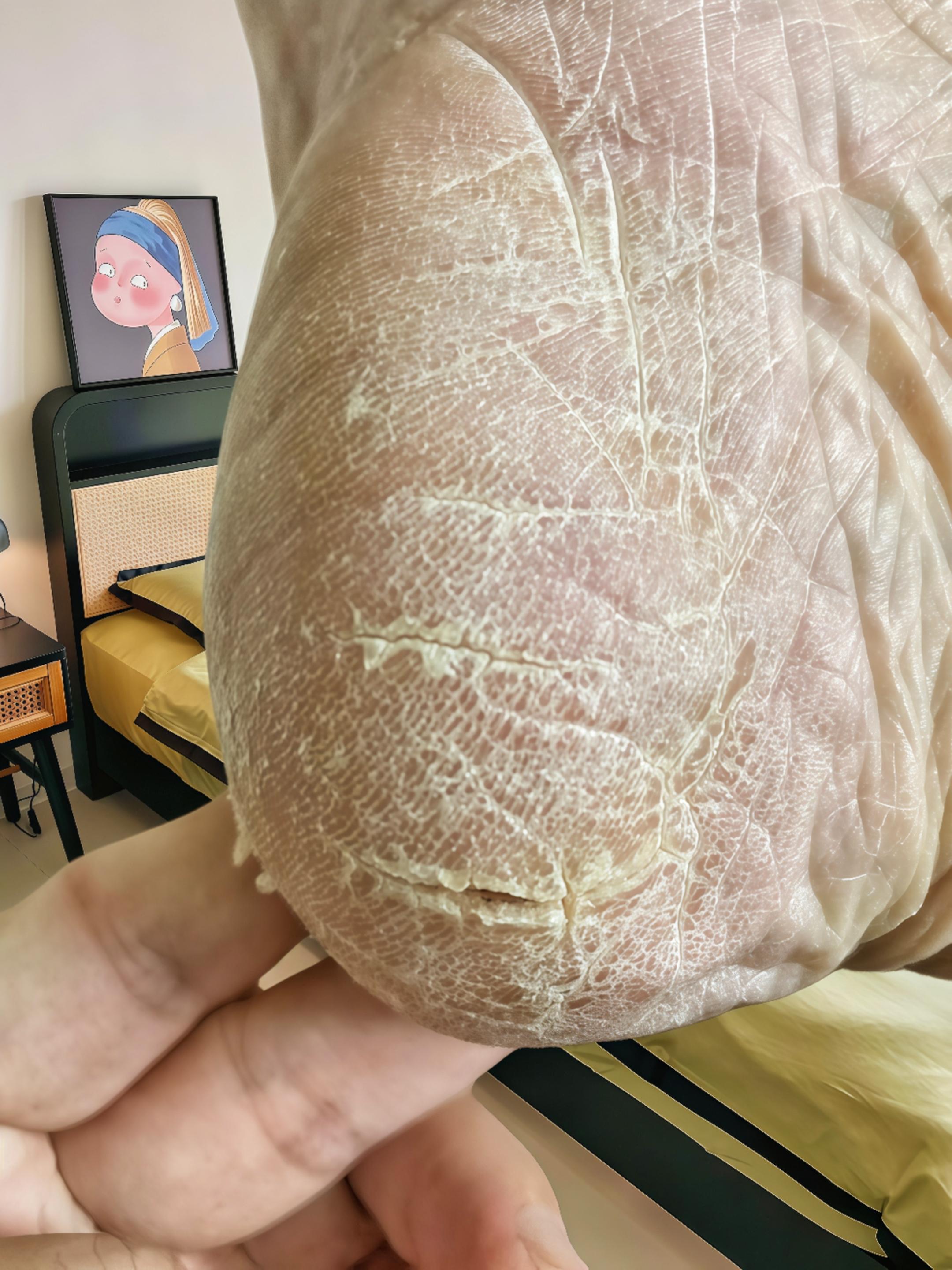 #强烈推荐 #手脚干裂 #自用好物分享 #爱了爱了 #脚丫子 终于找对了方法,一次尝试,没想到真的上岸了!