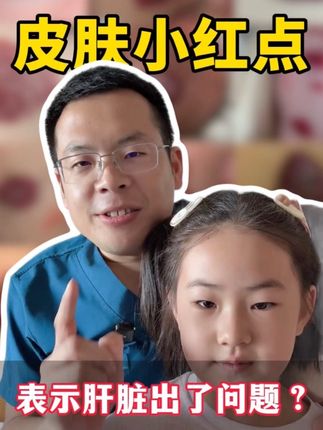 皮肤上起小红点表示肝脏出问题了吗? #樱桃状血管瘤 #红痣 #医学科普 #健康科普不基础 #抖出健康知识宝藏