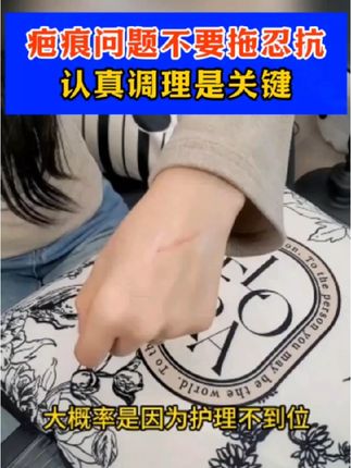 疤痕会增生有很大的原因,是因为护理不当,选对不选贵 #疤痕 #疤痕疙瘩 #淡疤 #淡疤小行家 #淡疤好物