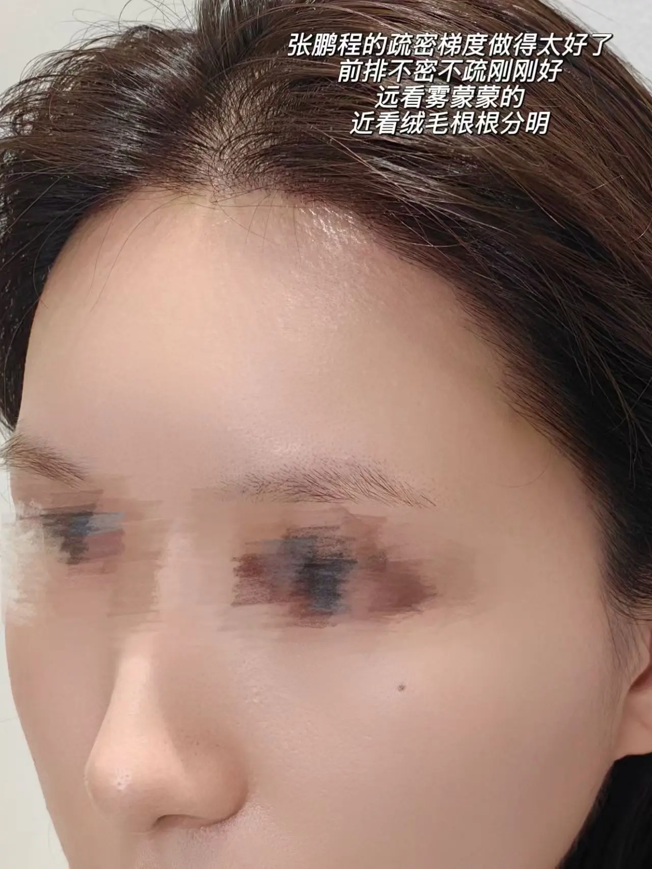 上海做的发际线就这?洗完头吹干,风筒不敢开太热不敢靠太近,生 - 抖音