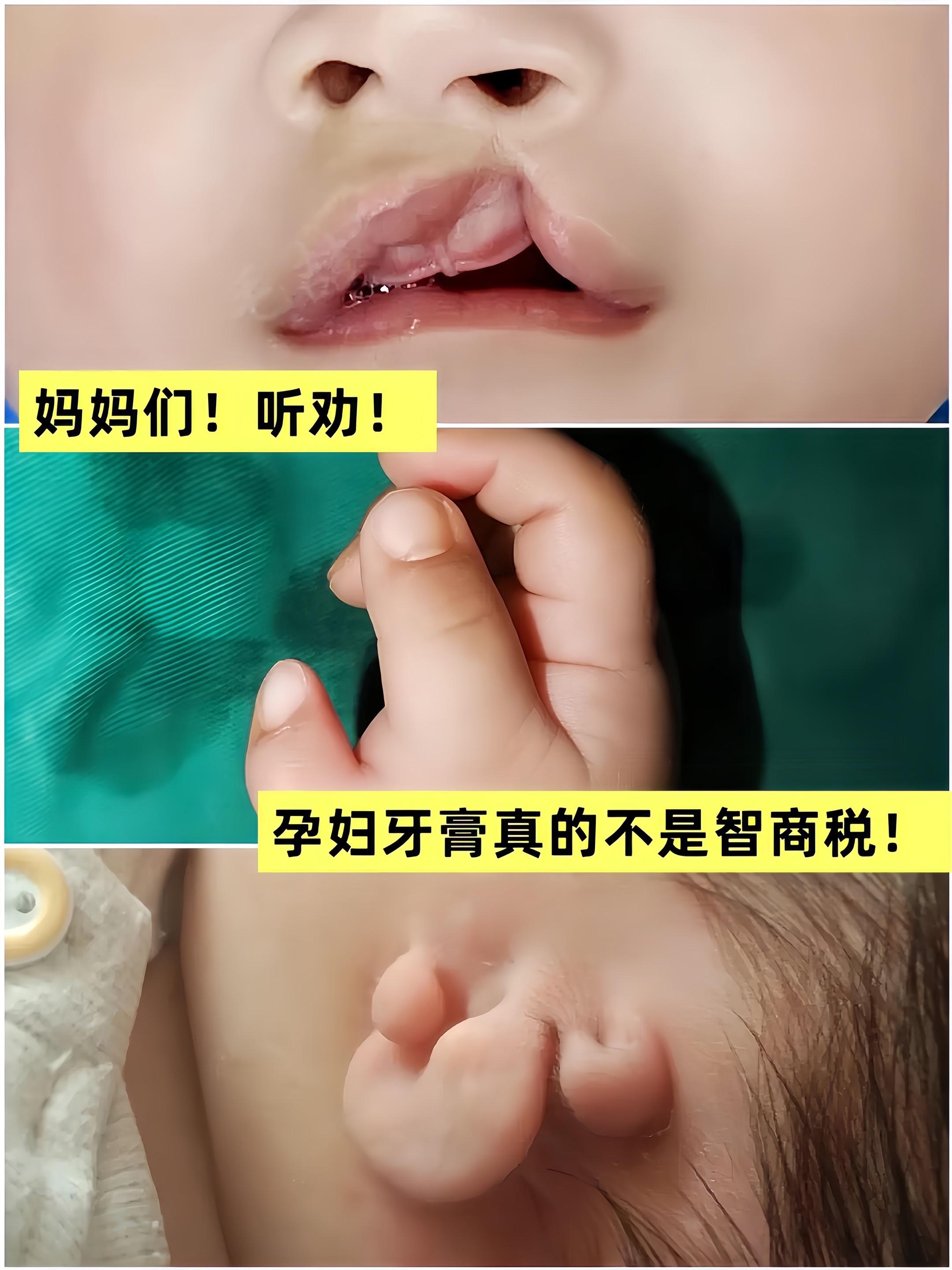 孕期刷牙不舒服?这款牙膏值得一试!含有果萃精华,味道清新,成分温和安全,孕反的姐妹放心入。#孕期口腔护理 #孕期囤货 #孕期 #一个身体两个心跳 #袋鼠妈妈牙膏